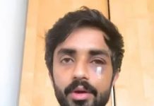 Pakistani student suffers facial fractures in racist attack in Glasgow